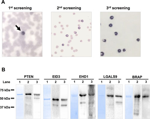 SEREX screening and western blot analysis of recombinant GST-fusion proteins.