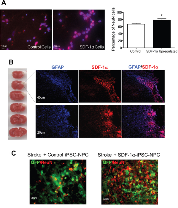 Expression of SDF-1&#x03B1; and neuronal differentiation of SDF-1&#x03B1;-iPS-NPCs in the post-ischemic brain.