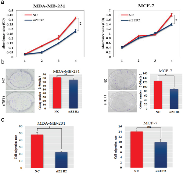 SiZEB2 inhibited BC cells proliferation and metastasis.