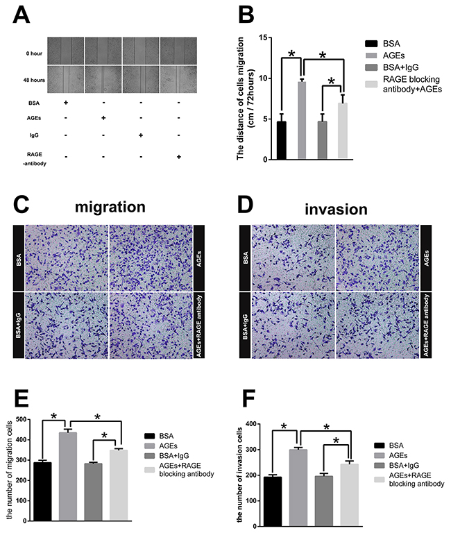 Effect of glucose-derived AGEs on wound healing, invasion, and migration ability in SGC7901 cells (200&#x00D7;).