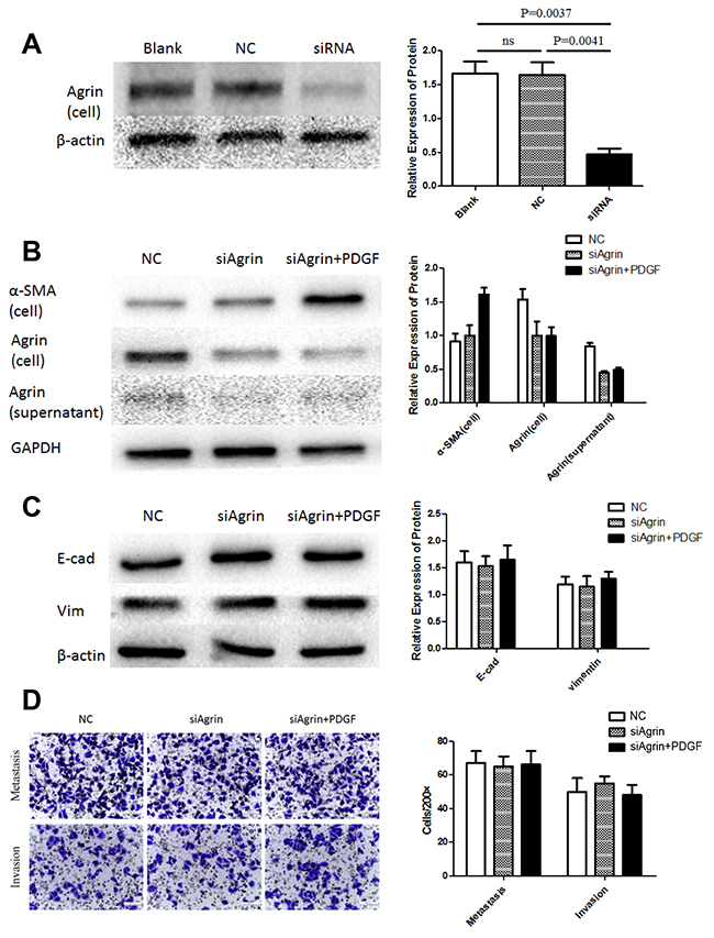 Agrin knockdown and its effect on migration and EMT in LX2 cells.