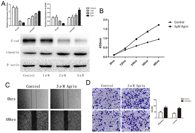 Effect of agrin supplementation on cell proliferation, migration, and EMT of SMMC-7721 cells.