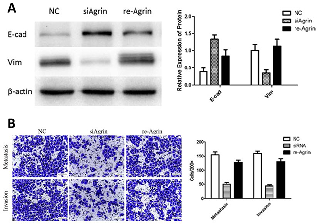 Effect of recombinant agrin on invasion and metastasis of SMMC-7721 cells.