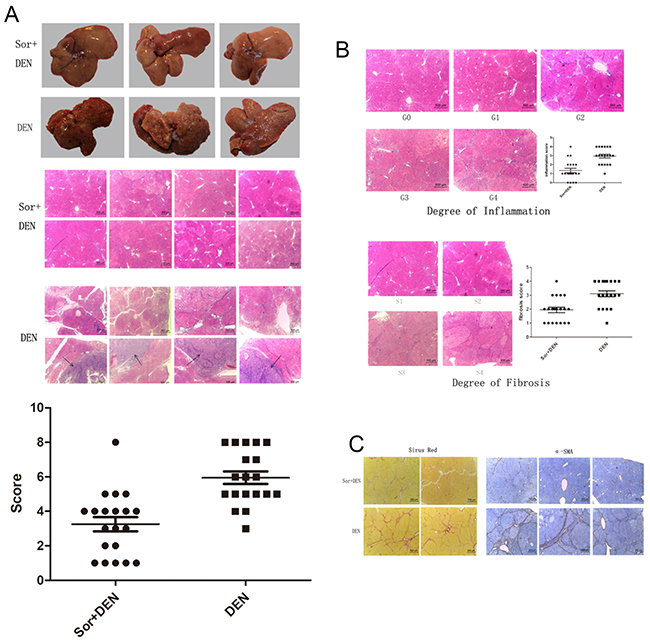 Effect of sorafinib on DEN-induced hepatocarcinogenesis in rats.