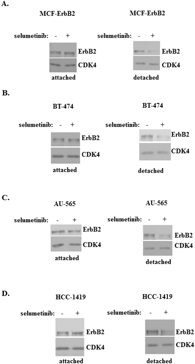 Mek activity is required for ErbB2 expression in breast cancer cells detached from the ECM.