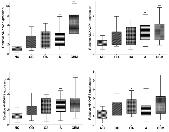 The qRT-PCR analysis of relative ANXA2 and ANXA2 pseudogenes expression level in 99 cases of tissues from diffuse glioma patients and 12 cases of non-tumor brain tissues.