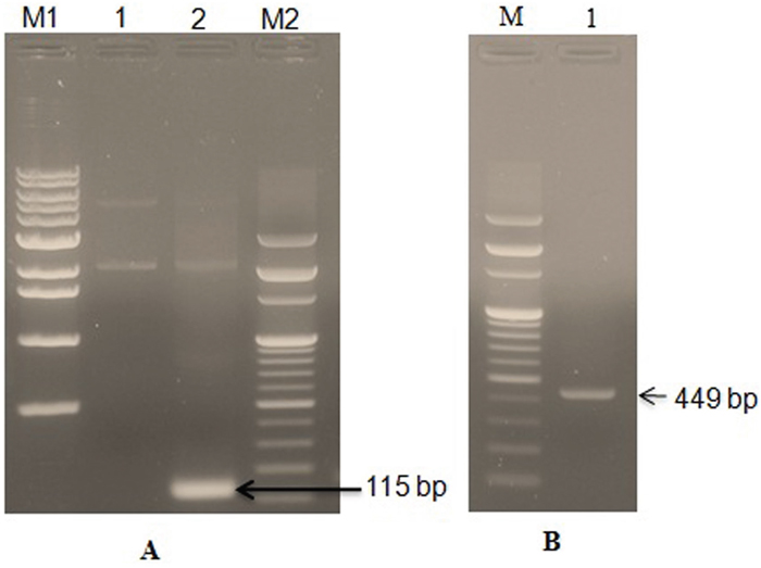 PCR detection and amplification of LFcinB gene in the pGEM-B1 plasmid.