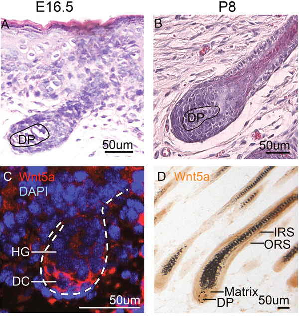 Wnt5a expression during hair development and growth.
