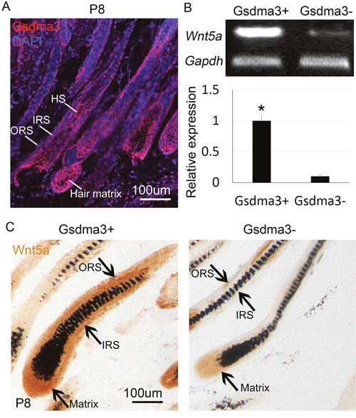 Decreased Wnt5a expression in Gsdma3-mutant mice.