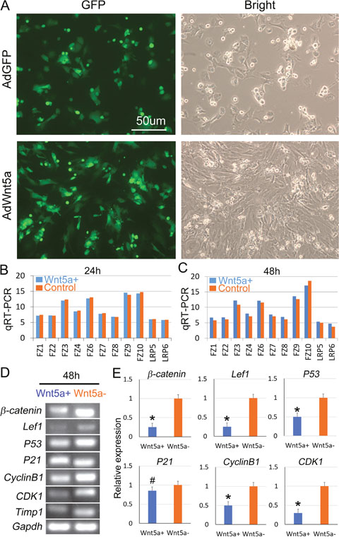 Overexpression of Wnt5a attenuates canonical Wnt signaling pathway in cultured DP cells.