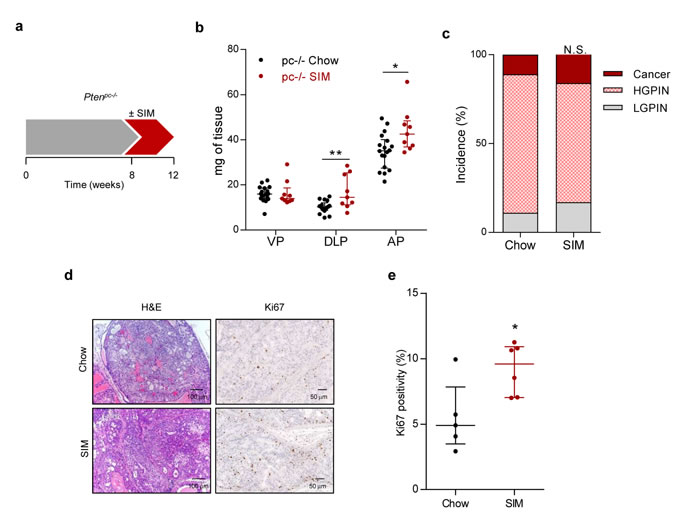 Simvastatin administration increases feature of aggressiveness in prostate cancer initiation.