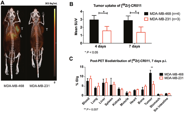 PET/CT imaging of [89Zr]DFO-CR011 in TNBC xenograft models at 4 days post-injection.