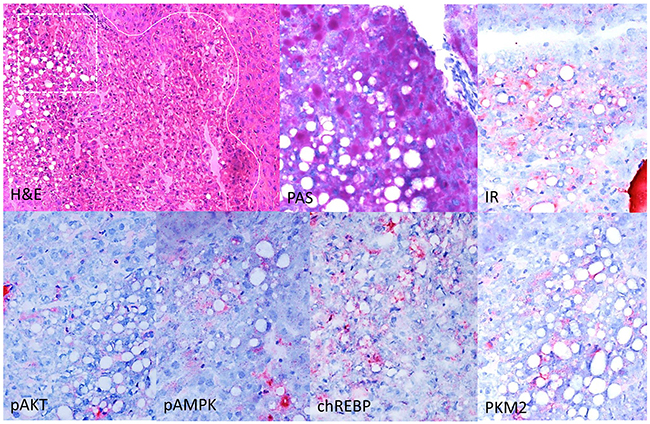 Immunohistochemical characterization of CCF in the liver of diabetic WT mice, one week after intraportal pancreatic islet transplantation.