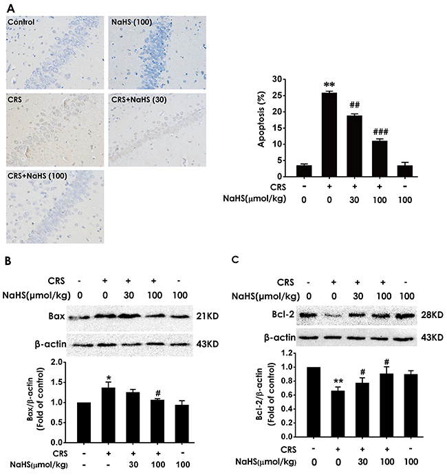 Effect of H2S on CRS-induced hippocampal apoptosis in rats.