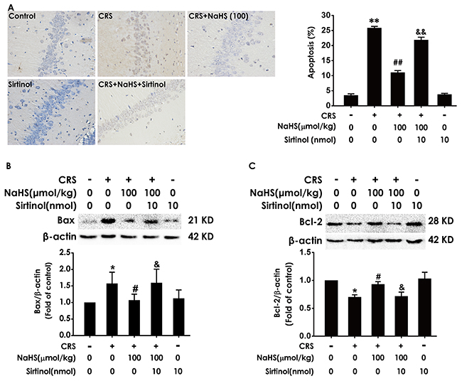 Effect of Sirtinol on H2S-meliorated hippocampal apoptosis in CRS-treated rats Rats were cotreated with NaHS (100 &#x03BC;mol/kg/d, i.p.) and CRS (6 h/d) for 4 w and injected with Sirtinol (10 nmol/d&#x00D7;1w, i.c.v.) at the last week simultaneously.