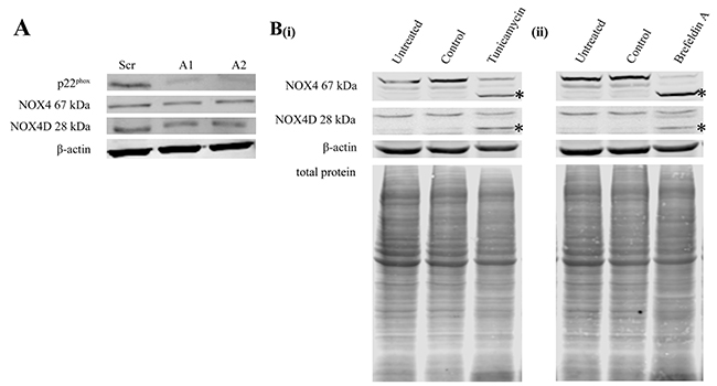 Knockdown of p22phox in FLT3-ITD expressing MV4-11 cells had no effect on NOX4 67 kDa and NOX4D 28 kDa protein expression. NOX4D 28 kDa is glycosylated in FLT3-ITD expressing AML.
