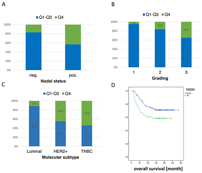 Hyperexpression of fascin is associated with poor clinical outcome.