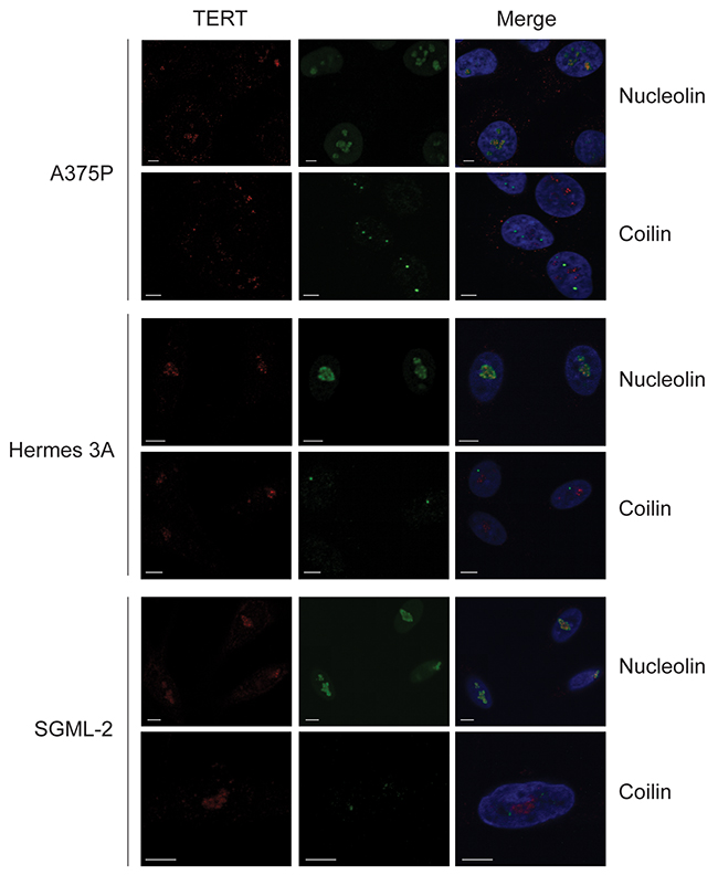 TERT colocalization with nucleolin, not coilin, in cultured human melanoma cells and melanocytes.