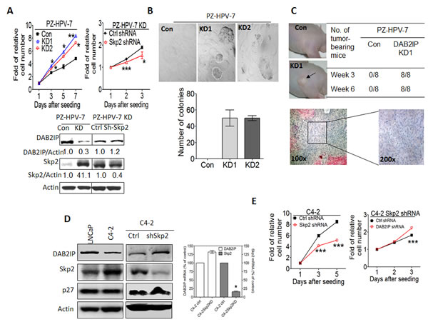 The effect of Skp2 on the tumor properties of prostatic cells from