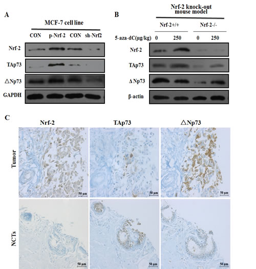 TAp73 and &#x394;Np73 expression are correlated with 5-aza-dC induced Nrf-2 expression in vitro and in vivo.