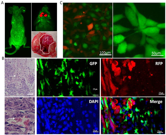 Characterization of SU3-RFP GSC and EGFP-BMSC interactions in intracranial xenograft tumors.