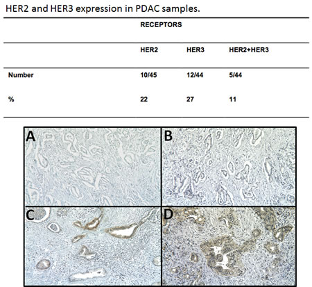 HER2 and HER3 expression was assessed by IHC in 42 pancreatic cancer samples.