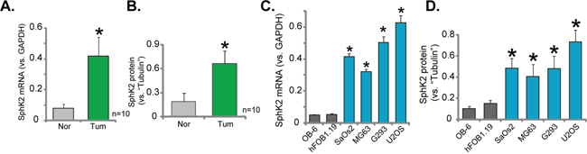 Over-expression of SphK2 in human OS tissues and OS cells.