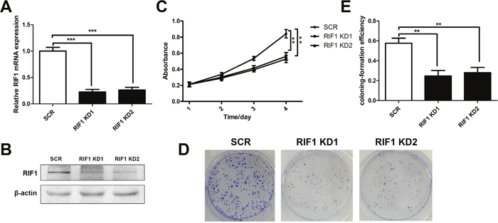 Knockdown of RIF1 inhibited the proliferation of cervical cancer cells.