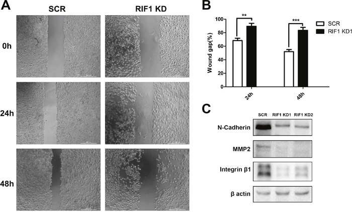 Downregulation of RIF1 decreased migration and EMT markers.