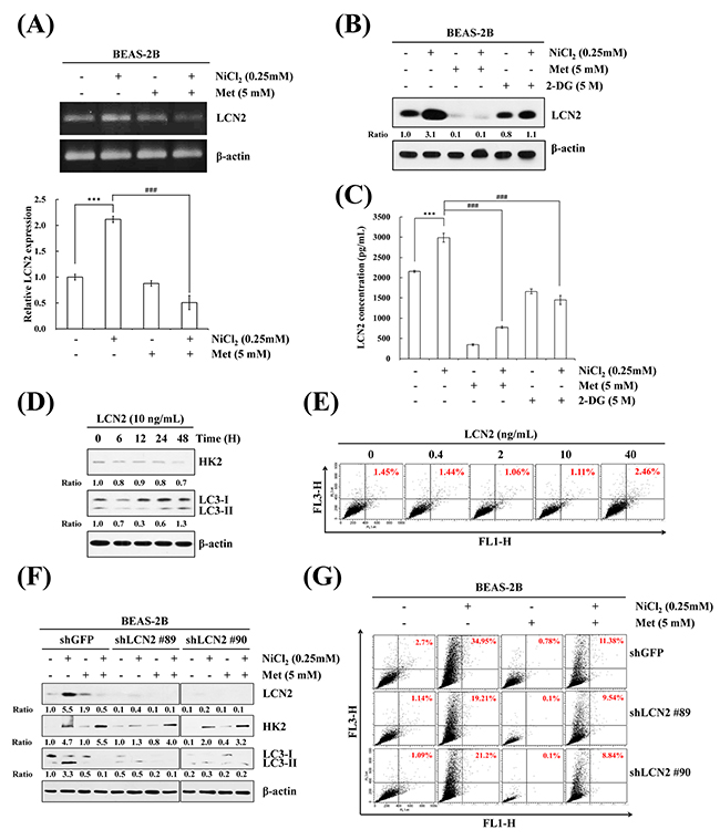 LCN2 is involved in NiCl2-induced autophagy in human bronchial epithelial cells.