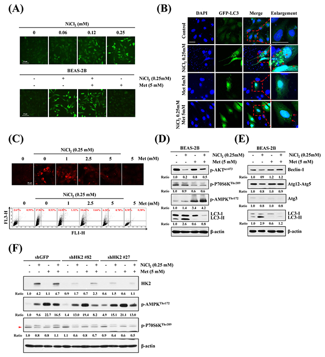 Effects of metformin on NiCl2-mediated autophagy in human bronchial epithelial cells.