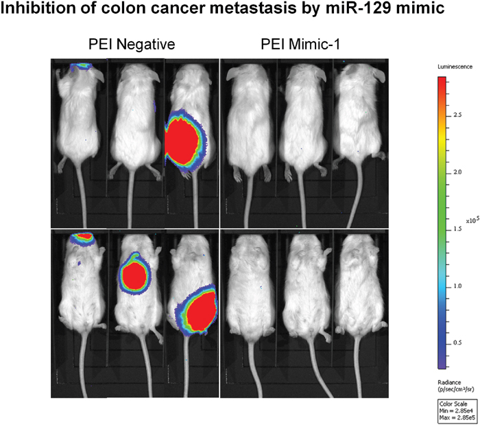 In vivo systemic treatment with Mimic-1 inhibits colon cancer metastasis.