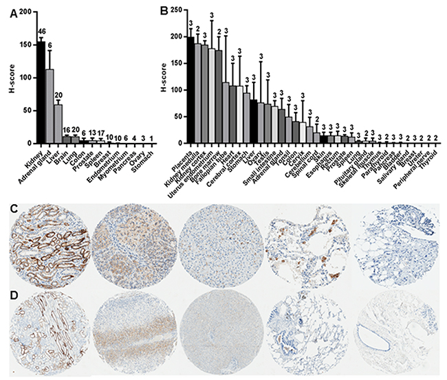 TfR1 levels in normal tissues of various body sites.