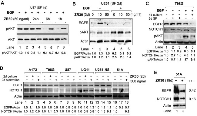 Effect of ZR30 on EGF-mediated activation of EGFR signaling and NOTCH1 expression by immunobloting.