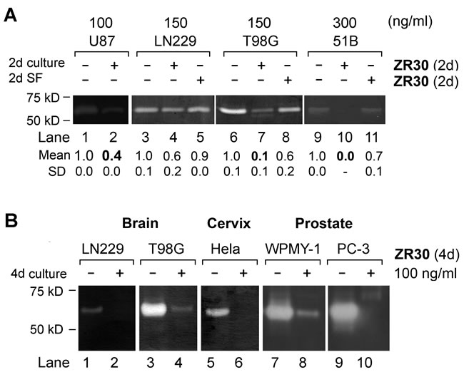 Effect of ZR30 on MMP2 activation by Gelatin zymography.