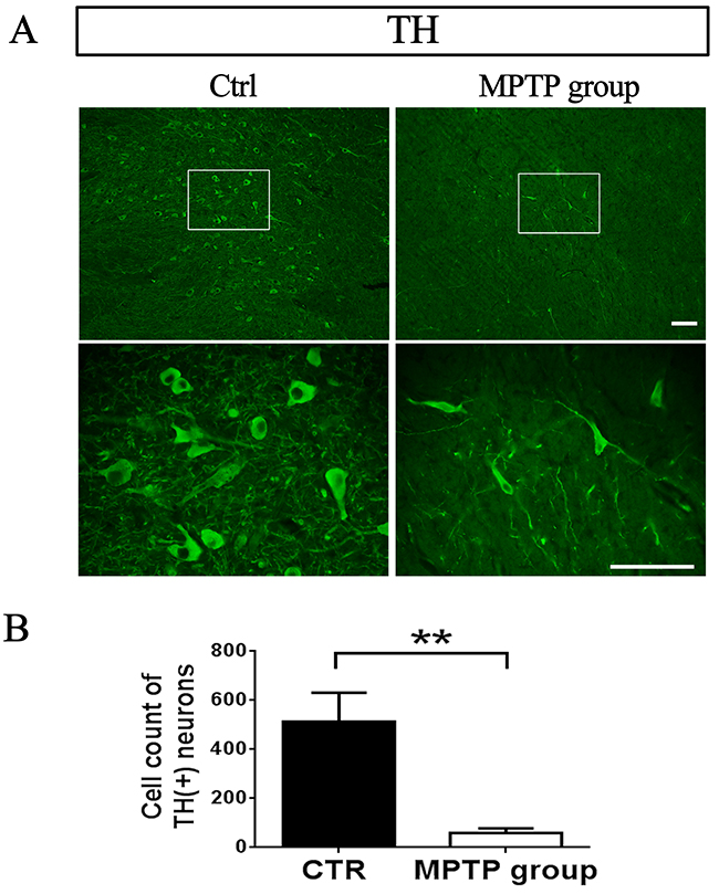 TH-positive neurons in SNpc decreased after MPTP injection.