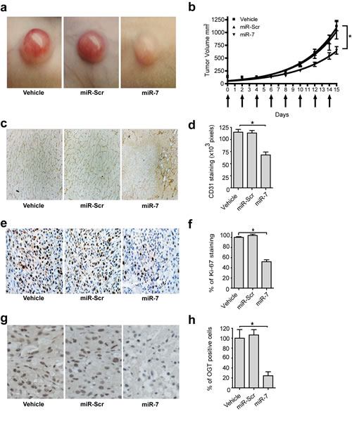 Inhibitory effect of miR-7 on tumor growth by systemic delivery.