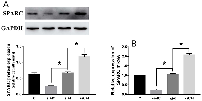 SPARC knock-down reduce the effect of hsa-miR-29c-3p up-expression in colorectal cancer cell.