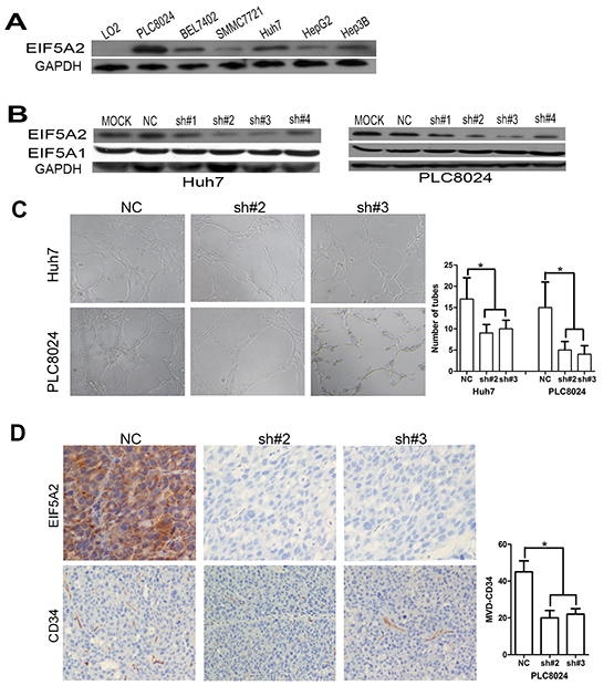 EIF5A2 downregulation represses tumor angiogenesis.