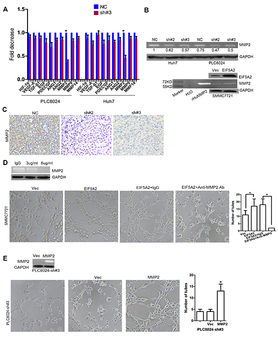 MMP-2 is required for EIF5A2-induced angiogenesis in HCC.