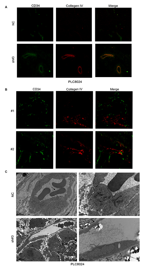EIF5A2 ablation increases micro-vessel wall continuity and promotes normal endothelial cell lining and differentiation.