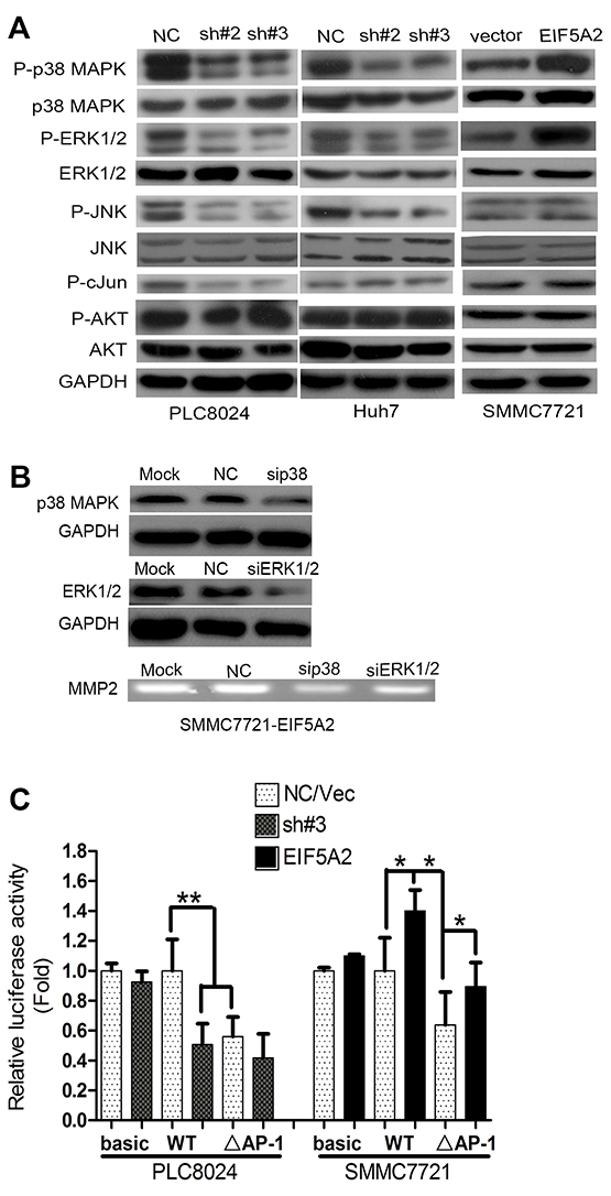 EIF5A2 induces MMP-2 transcription by activating p38 MAPK and JNK/c-Jun pathways.