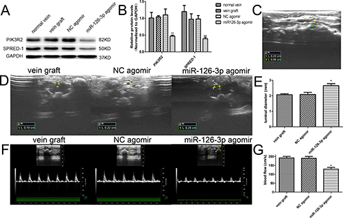 Exogenous miR-126-3p improved blood flow in vein grafts in vivo.