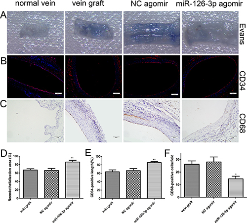 miR-126-3p agomir promoted reendothelialization in vivo.