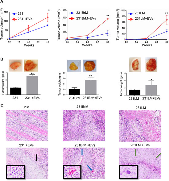 hMSC-EVs support primary breast tumor growth.
