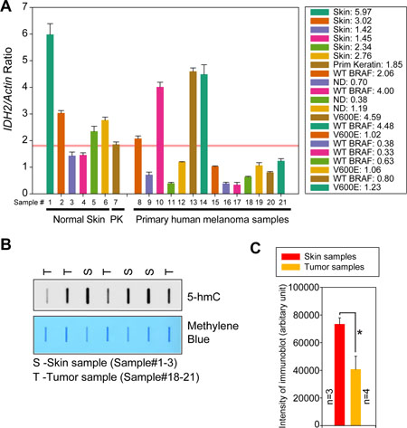 Downregulation of IDH2 mRNA expression in melanoma patient samples.