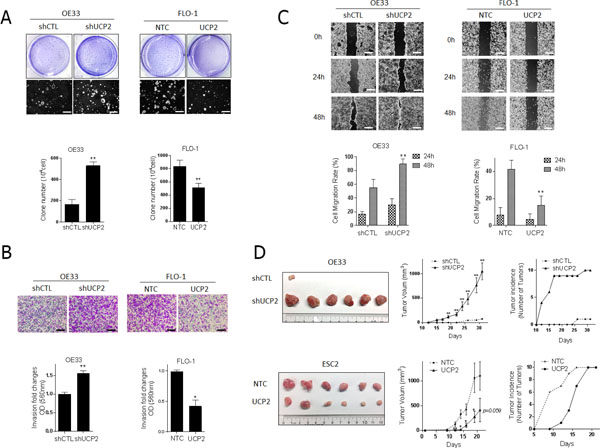 UCP2 impairs malignant progression of esophageal cancer cells.