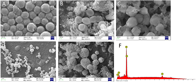 Representative of SEM images and EDS results.