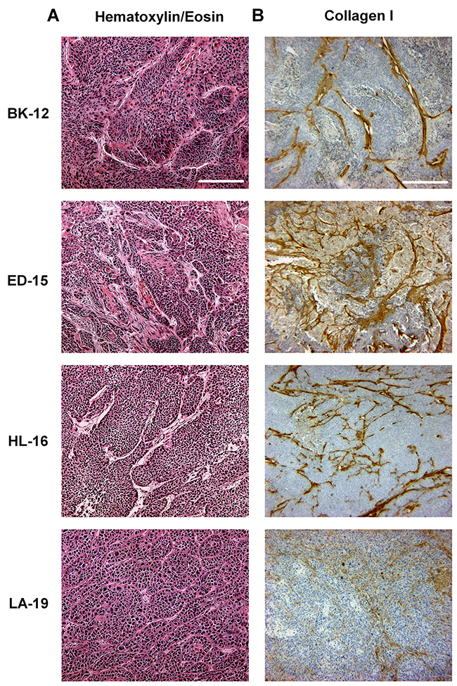 Histological appearance of BK-12, ED-15, HL-16, and LA-19 xenografts.