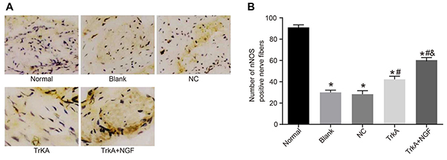 Immunohistochemical results of penile cavernous tissue in rats (&#x00D7; 400) and the number of nNOS positive nerve fibers.